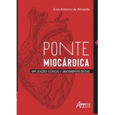 Ponte miocárdica